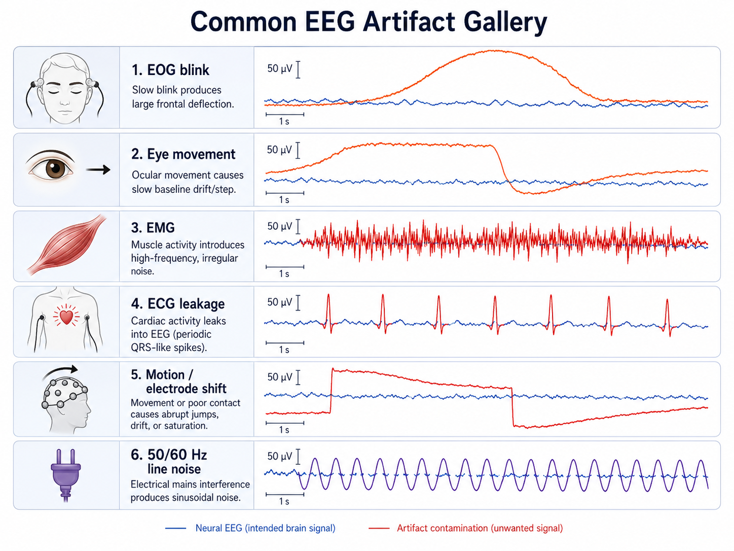 Artifact gallery. Aligned EEG traces illustrate common contamination sources, including EOG blinks and eye movements, EMG, ECG leakage, electrode or cable motion, and 50/60 Hz line noise. The traces are paired with source labels so physiological, environmental, and movement artifacts can be distinguished from neural signal.