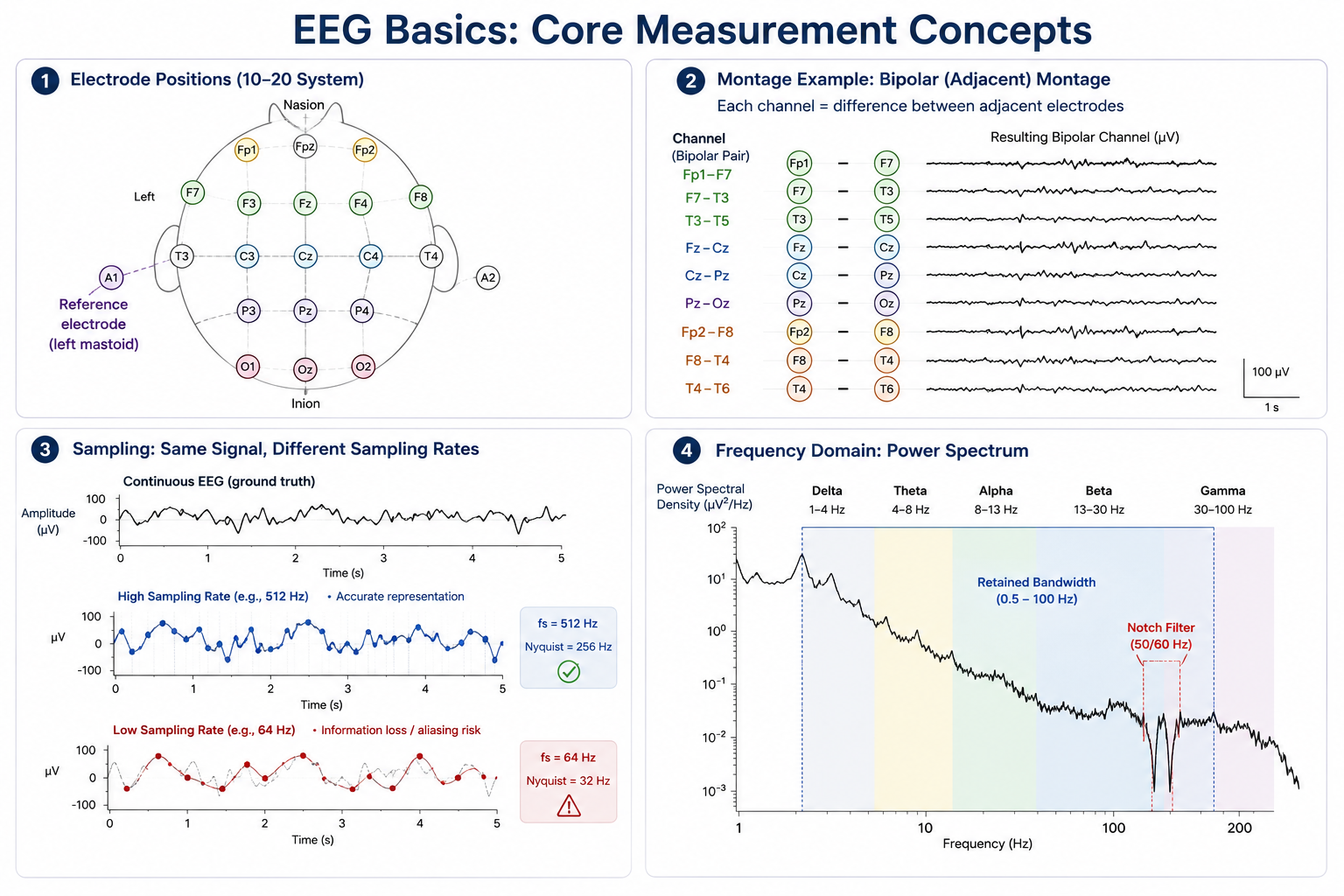 Core measurement concepts. Top left: electrode positions on a 10-20 layout with a reference electrode highlighted. Top right: a montage expressed as bipolar channel combinations. Bottom left: the same continuous waveform sampled at high and low rates. Bottom right: a power spectrum with the retained bandwidth shaded and the 50/60 Hz notch removed.